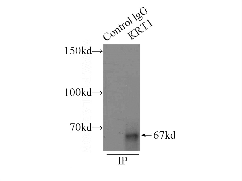 IP Result of anti-KRT1-specific (IP:Catalog No:109804, 3ug; Detection:Catalog No:109804 1:500) with A431 cells lysate 3500ug.