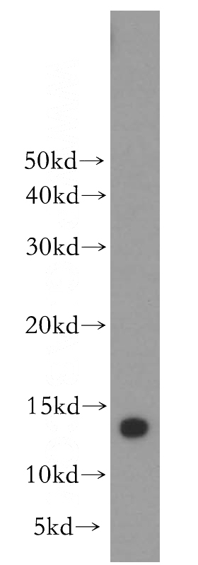 HeLa cells were subjected to SDS PAGE followed by western blot with Catalog No:112794(MTPN antibody) at dilution of 1:300