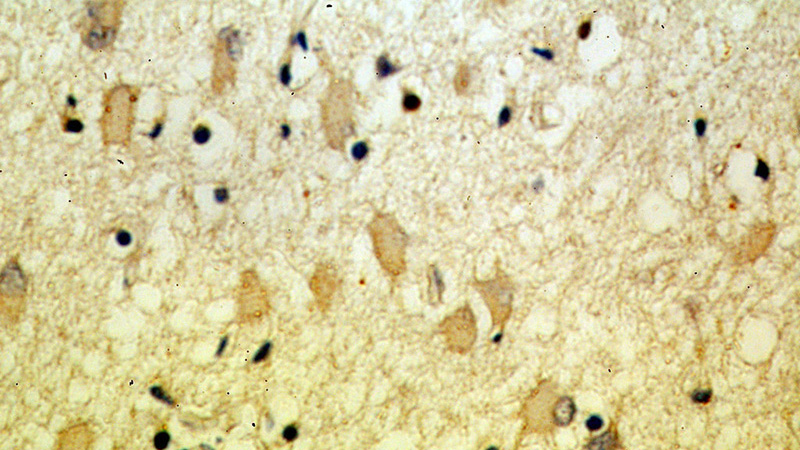 Immunohistochemical of paraffin-embedded human brain using Catalog No:114209(PRMT8 antibody) at dilution of 1:50 (under 40x lens)