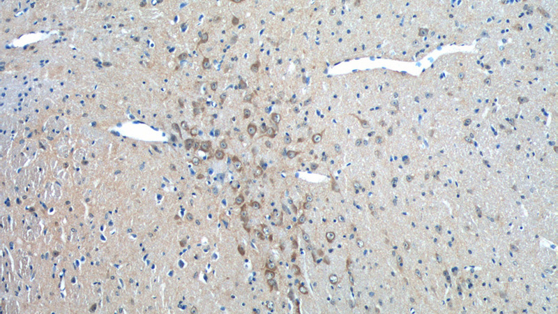 Immunohistochemistry of paraffin-embedded mouse brain tissue slide using Catalog No:112236(LIN7A Antibody) at dilution of 1:50 (under 10x lens)
