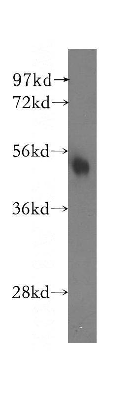 human liver tissue were subjected to SDS PAGE followed by western blot with Catalog No:112950(NARF antibody) at dilution of 1:400