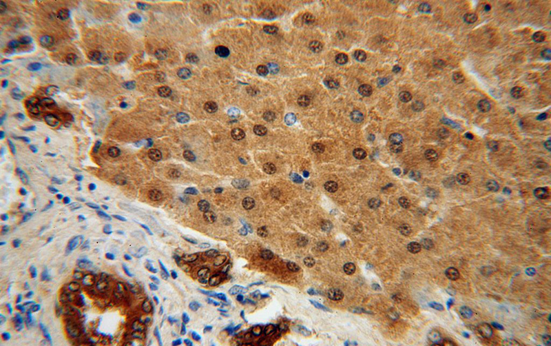 Immunohistochemical of paraffin-embedded human liver using Catalog No:115677(STARD10 antibody) at dilution of 1:100 (under 40x lens)