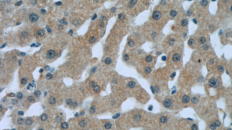 Immunohistochemistry of paraffin-embedded human liver tissue slide using Catalog No:108687(C1QC Antibody) at dilution of 1:50 (under 40x lens)