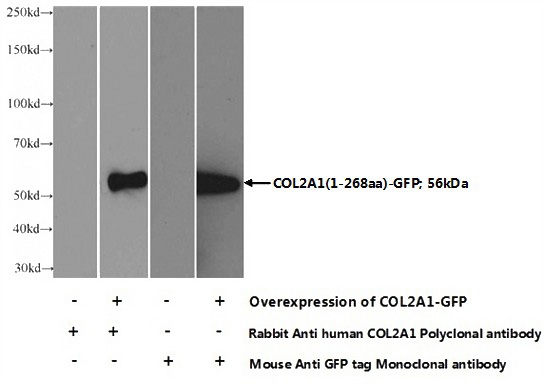 WB result of anti-COL2A1 (Catalog No:109376) with overexpressed protein COL2A1(1-268aa)-GFP.
