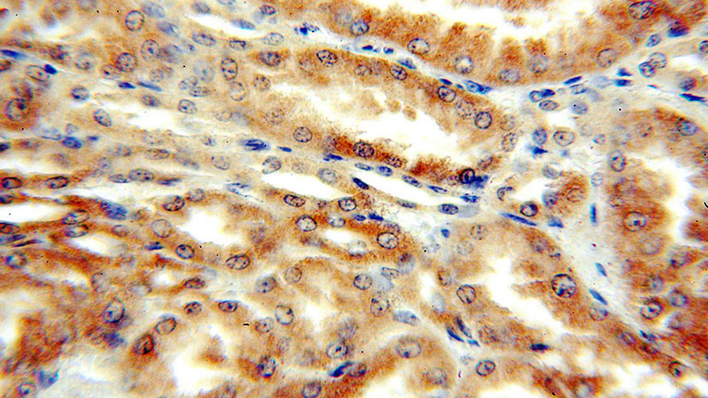 Immunohistochemical of paraffin-embedded human kidney using Catalog No:109756(TRAILR4 antibody) at dilution of 1:50 (under 40x lens)