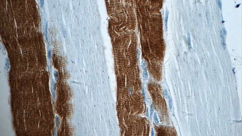 Immunohistochemistry of paraffin-embedded human skeletal muscle tissue slide using Catalog No:116152(TNNI2 Antibody) at dilution of 1:50 (under 40x lens)
