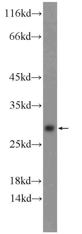 mouse liver tissue were subjected to SDS PAGE followed by western blot with Catalog No:117136(BHLHA15 Antibody) at dilution of 1:300