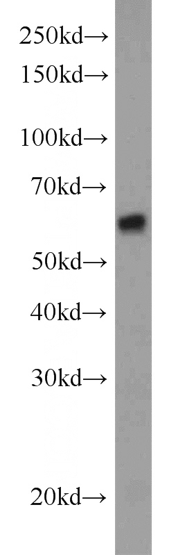 A549 cells were subjected to SDS PAGE followed by western blot with Catalog No:115895(TBXAS1 antibody) at dilution of 1:500