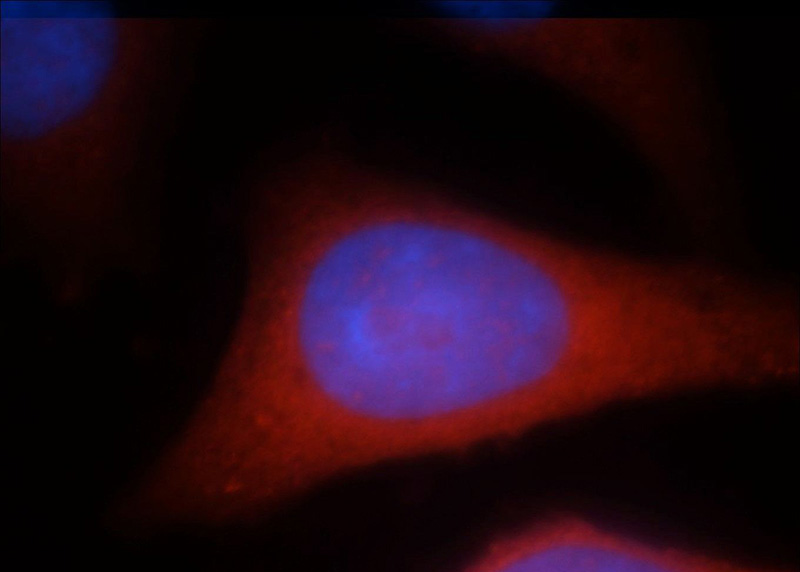 Immunofluorescent analysis of HepG2 cells, using RAB3GAP1 antibody Catalog No:114445 at 1:25 dilution and Rhodamine-labeled goat anti-rabbit IgG (red). Blue pseudocolor = DAPI (fluorescent DNA dye).