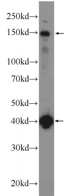 mouse brain tissue were subjected to SDS PAGE followed by western blot with Catalog No:111985(KIAA0774 Antibody) at dilution of 1:1000