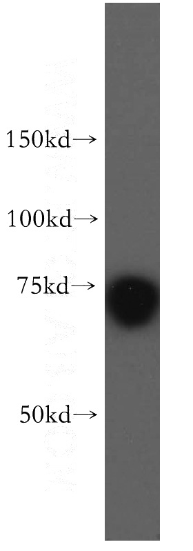 MCF7 cells were subjected to SDS PAGE followed by western blot with Catalog No:110112(DUS3L antibody) at dilution of 1:500