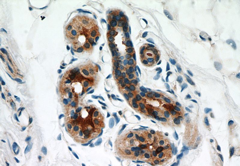 Immunohistochemical of paraffin-embedded human skin using Catalog No:114933(RSAD2 antibody) at dilution of 1:50 (under 10x lens)