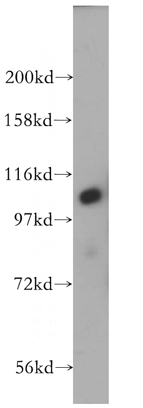 human brain tissue were subjected to SDS PAGE followed by western blot with Catalog No:111874(INTS5 antibody) at dilution of 1:500