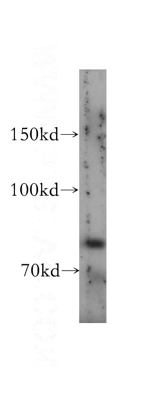 human lung tissue were subjected to SDS PAGE followed by western blot with Catalog No:110039(DTX3L antibody) at dilution of 1:500