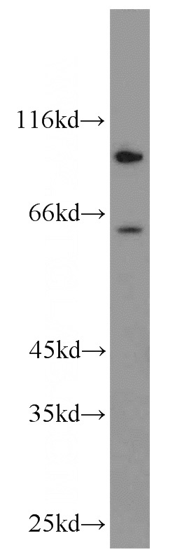 HeLa cells were subjected to SDS PAGE followed by western blot with Catalog No:110387(EPHX2 antibody) at dilution of 1:1000