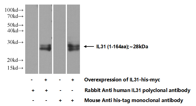 Transfected HEK-293 cells were subjected to SDS PAGE followed by western blot with Catalog No:111736(IL31 Antibody) at dilution of 1:1000