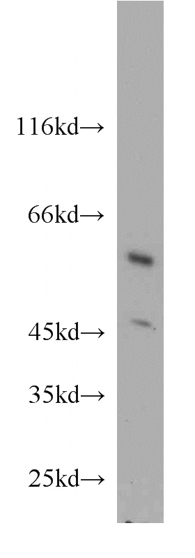 HeLa cells were subjected to SDS PAGE followed by western blot with Catalog No:113570(PANK2 antibody) at dilution of 1:100