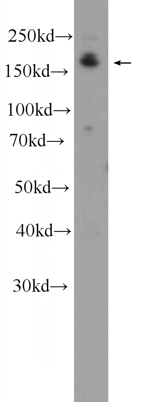 A549 cells were subjected to SDS PAGE followed by western blot with Catalog No:109862(DAPK1 Antibody) at dilution of 1:600