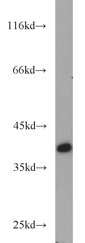 mouse brain tissue were subjected to SDS PAGE followed by western blot with Catalog No:113364(NUDT9 antibody) at dilution of 1:1000
