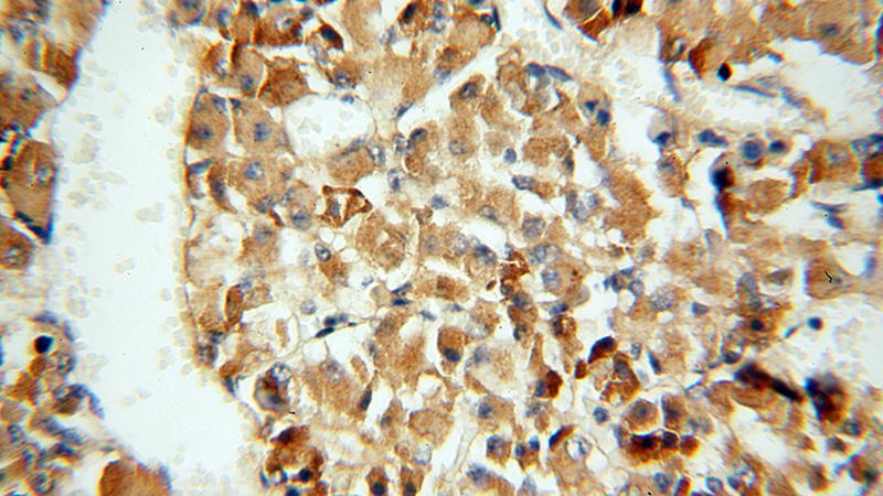 Immunohistochemical of paraffin-embedded human pituitary using Catalog No:108852(CPE antibody) at dilution of 1:50 (under 40x lens)