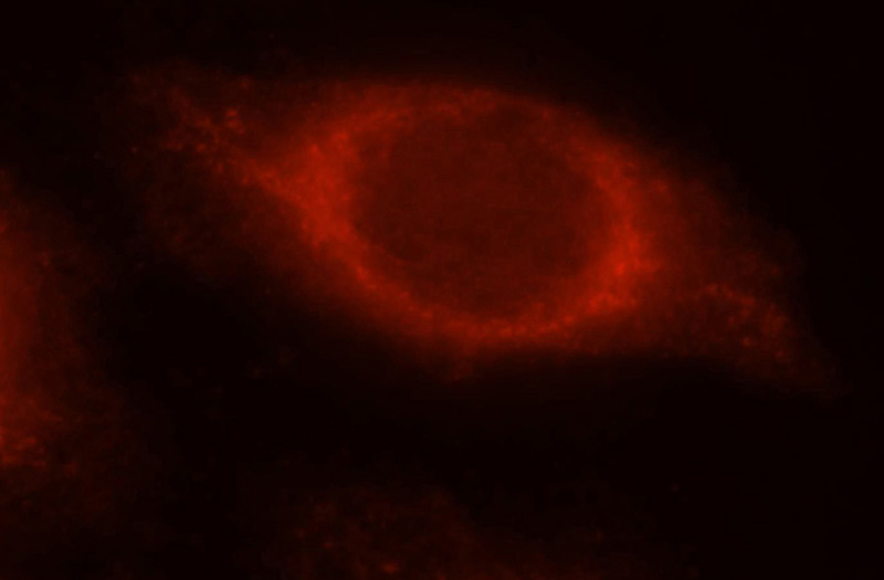 Immunofluorescent analysis of Hela cells, using SPERT antibody Catalog No:115564 at 1:25 dilution and Rhodamine-labeled goat anti-rabbit IgG (red).