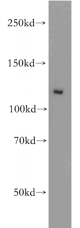 HeLa cells were subjected to SDS PAGE followed by western blot with Catalog No:113870(PIK3CA antibody) at dilution of 1:500