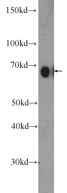 HEK-293T cells were subjected to SDS PAGE followed by western blot with Catalog No:114168(PRC1 Antibody) at dilution of 1:600