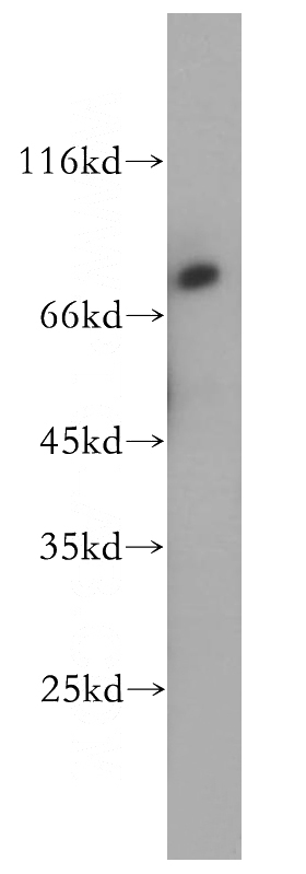 Jurkat cells were subjected to SDS PAGE followed by western blot with Catalog No:112763(MTA2 antibody) at dilution of 1:800