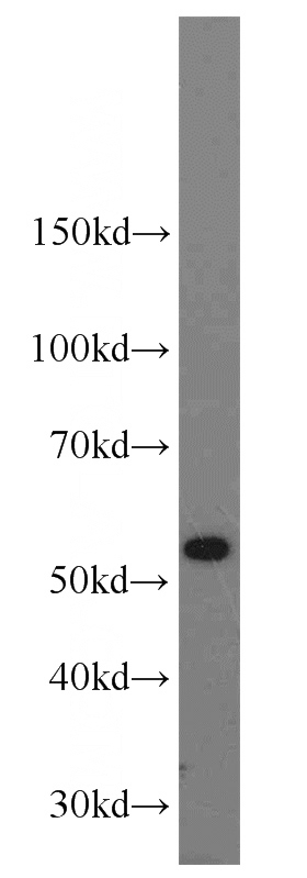 HeLa cells were subjected to SDS PAGE followed by western blot with Catalog No:115277(SHMT2 antibody) at dilution of 1:800