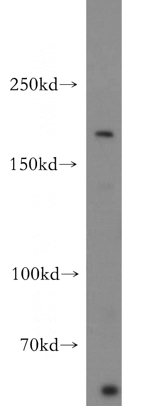 SH-SY5Y cells were subjected to SDS PAGE followed by western blot with Catalog No:113283(NRXN1 antibody) at dilution of 1:500