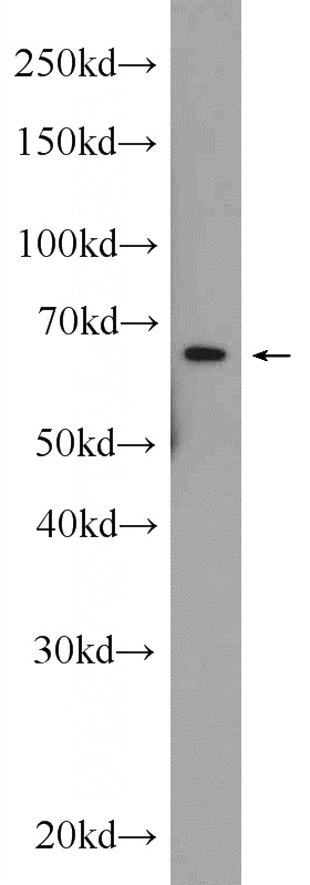 HEK-293 cells were subjected to SDS PAGE followed by western blot with Catalog No:111330(HACE1 Antibody) at dilution of 1:600