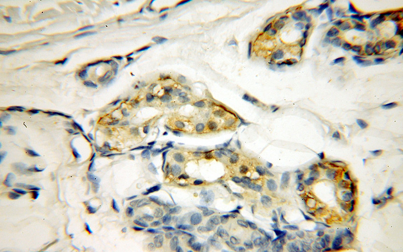 Immunohistochemical of paraffin-embedded human skin using Catalog No:109791(KRT13-Specific antibody) at dilution of 1:50 (under 40x lens)
