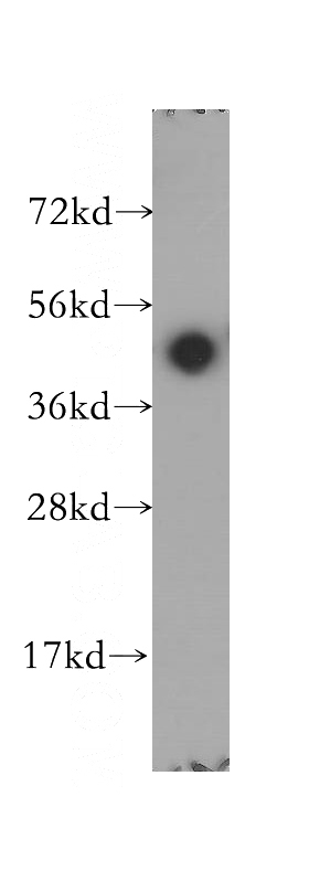 A375 cells were subjected to SDS PAGE followed by western blot with Catalog No:110086(DNAJA2 antibody) at dilution of 1:500