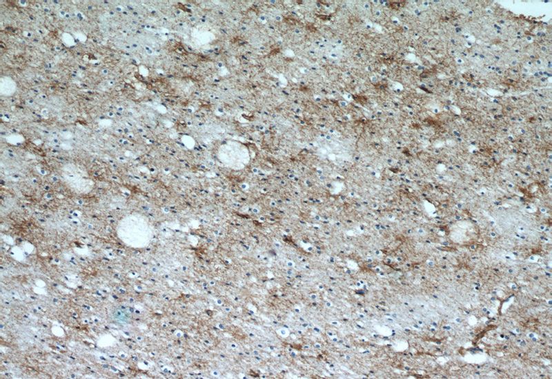 Immunohistochemical of paraffin-embedded human brain using Catalog No:114263(PTCH2 antibody) at dilution of 1:50 (under 10x lens)