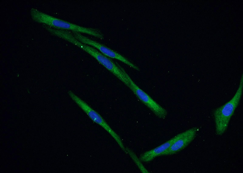 Immunofluorescent analysis of SKOV-3 cells using Catalog No:111688(IGFBP5 Antibody) at dilution of 1:50 and Alexa Fluor 488-congugated AffiniPure Goat Anti-Rabbit IgG(H+L)
