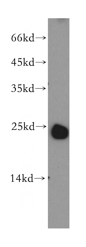mouse lymph tissue were subjected to SDS PAGE followed by western blot with Catalog No:112143(LAPTM4B antibody) at dilution of 1:800