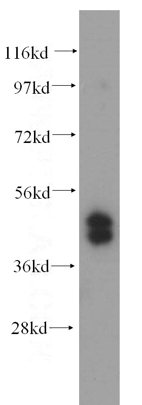 HepG2 cells were subjected to SDS PAGE followed by western blot with Catalog No:116352(TRBP antibody) at dilution of 1:1000