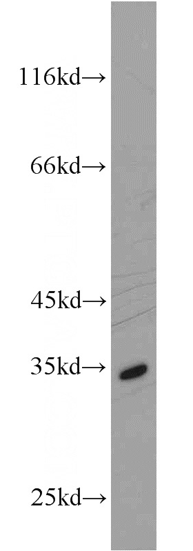 HL-60 cells were subjected to SDS PAGE followed by western blot with Catalog No:110319(ENOPH1 antibody) at dilution of 1:1500