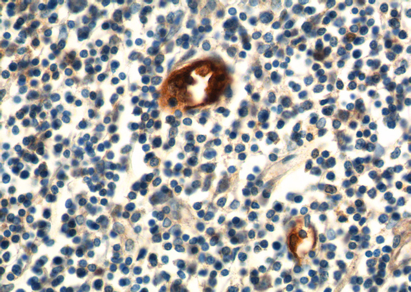 Immunohistochemistry of paraffin-embedded human small intestine tissue slide using Catalog No:112370(MADCAM1 Antibody) at dilution of 1:200 (under 40x lens).