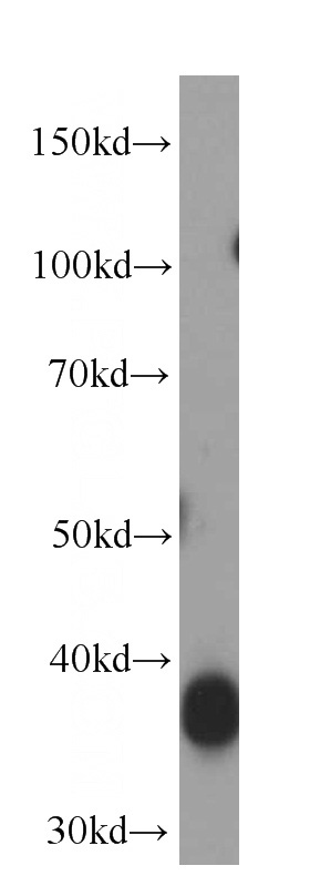 human heart tissue were subjected to SDS PAGE followed by western blot with Catalog No:107571(ALDoc antibody) at dilution of 1:10000