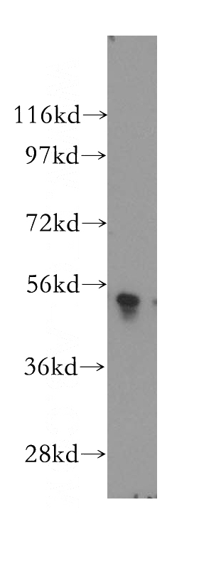 A375 cells were subjected to SDS PAGE followed by western blot with Catalog No:114017(PLXDC2 antibody) at dilution of 1:500