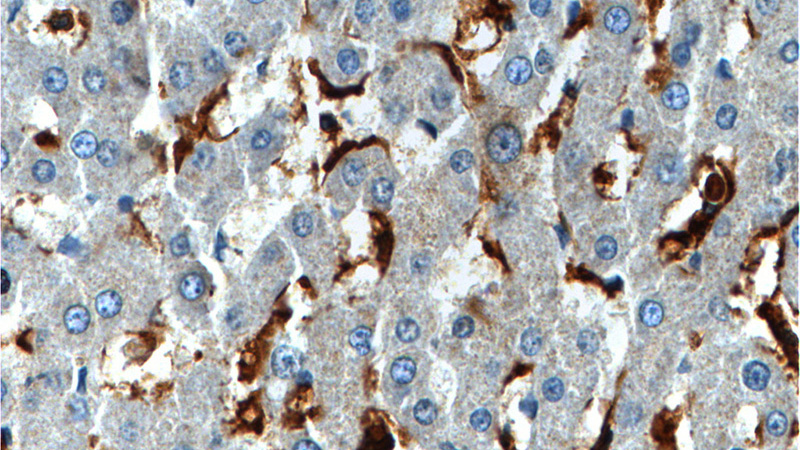 Immunohistochemistry of paraffin-embedded human liver tissue slide using Catalog No:109058(CD16 Antibody) at dilution of 1:200 (under 40x lens).
