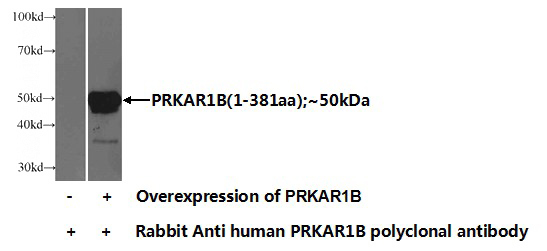 Transfected HEK-293 cells were subjected to SDS PAGE followed by western blot with Catalog No:114196(PRKAR1B Antibody) at dilution of 1:1000