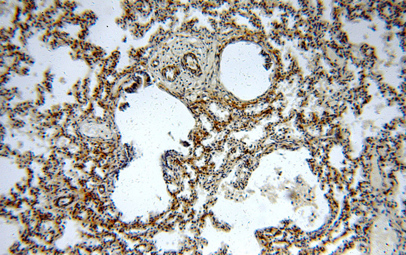Immunohistochemical of paraffin-embedded human lung using Catalog No:111348(C11orf73 antibody) at dilution of 1:100 (under 10x lens)