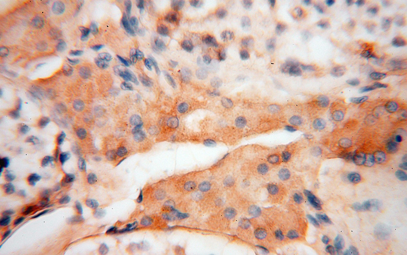 Immunohistochemical of paraffin-embedded human testis using Catalog No:113082(NDUFS3 antibody) at dilution of 1:50 (under 40x lens)