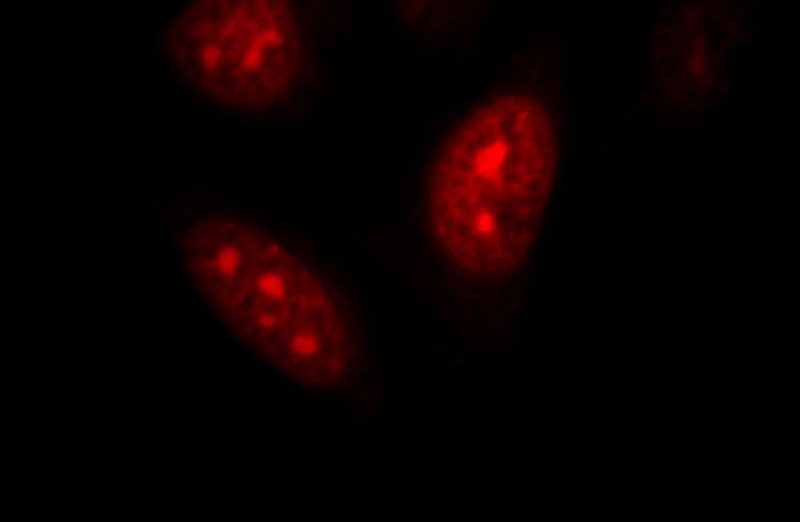 Immunofluorescent analysis of HepG2 cells, using DNAJB6 antibody Catalog No:110097 at 1:25 dilution and Rhodamine-labeled goat anti-rabbit IgG (red).