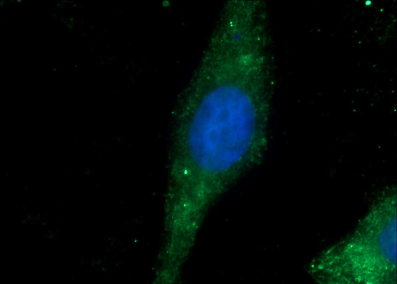 Immunofluorescent analysis of HepG2 cells using Catalog No:111100(GMIP Antibody) at dilution of 1:25 and Alexa Fluor 488-congugated AffiniPure Goat Anti-Rabbit IgG(H+L)