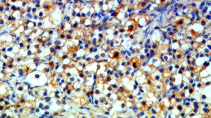 Immunohistochemical of paraffin-embedded human ovary using Catalog No:112756(MPRIP antibody) at dilution of 1:100 (under 40x lens)