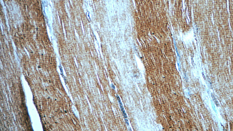 Immunohistochemistry of paraffin-embedded human skeletal muscle tissue slide using Catalog No:112927(MYH1 Antibody) at dilution of 1:50 (under 40x lens)