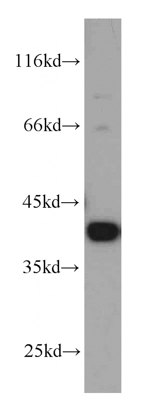 Raji cells were subjected to SDS PAGE followed by western blot with Catalog No:112549(MCL1 antibody) at dilution of 1:1000